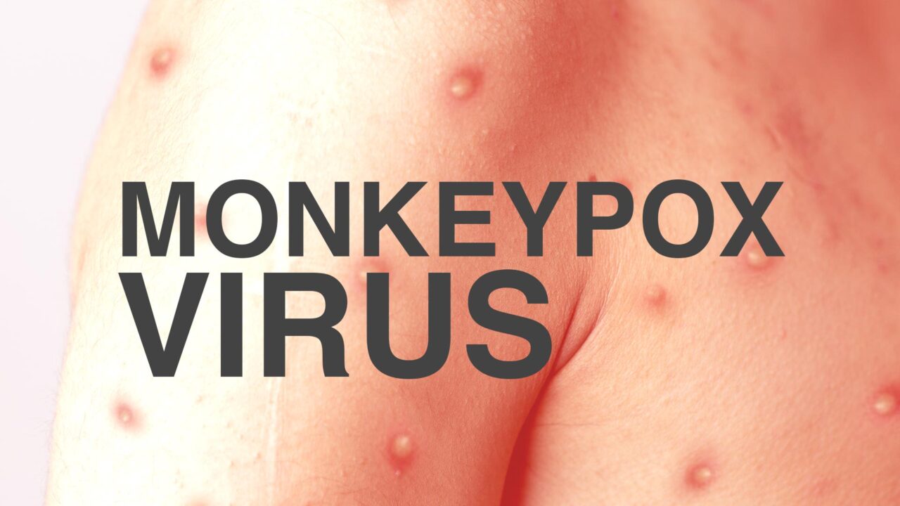 monkeypox-virus-1280x720.jpg